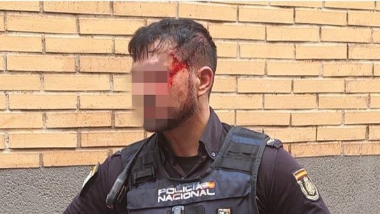 Un agente de la Policía Nacional sufre un traumatismo craneoencefálico y seis puntos de sutura al ser agredido con una estaca en Murcia (foto: JUPOL)